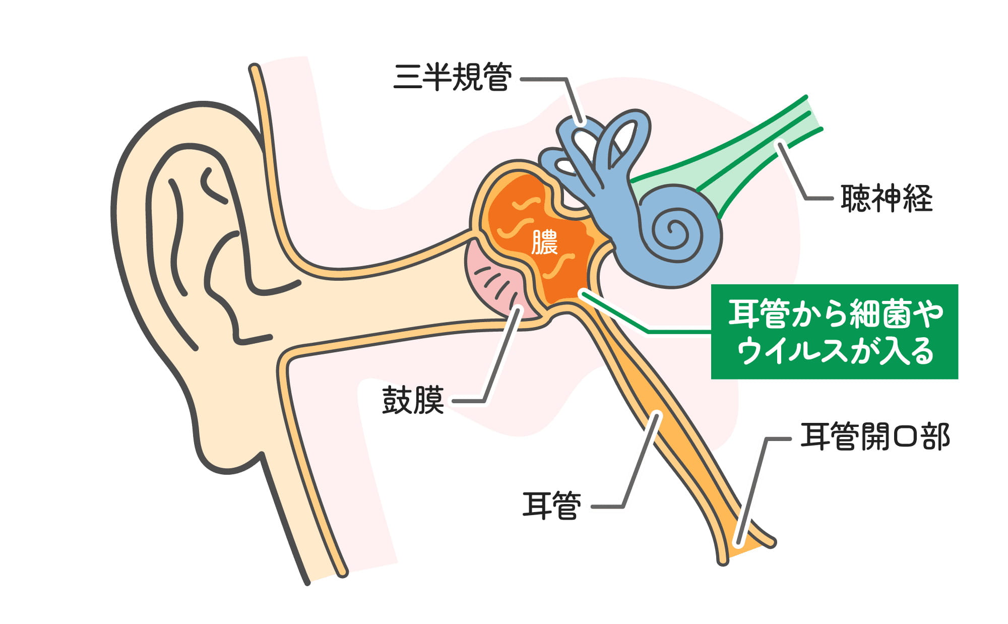 急性中耳炎とは