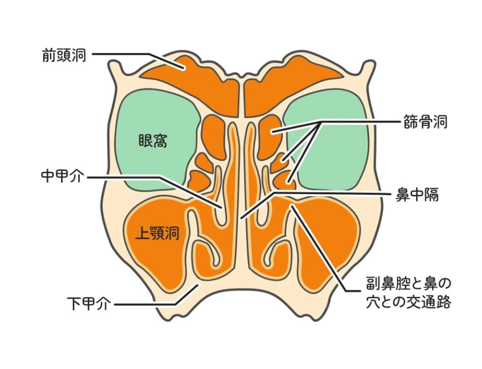 慢性副鼻腔炎（蓄膿症）とは