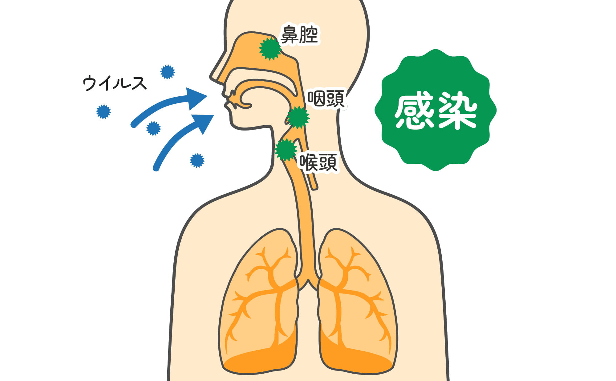 風邪（上気道炎）