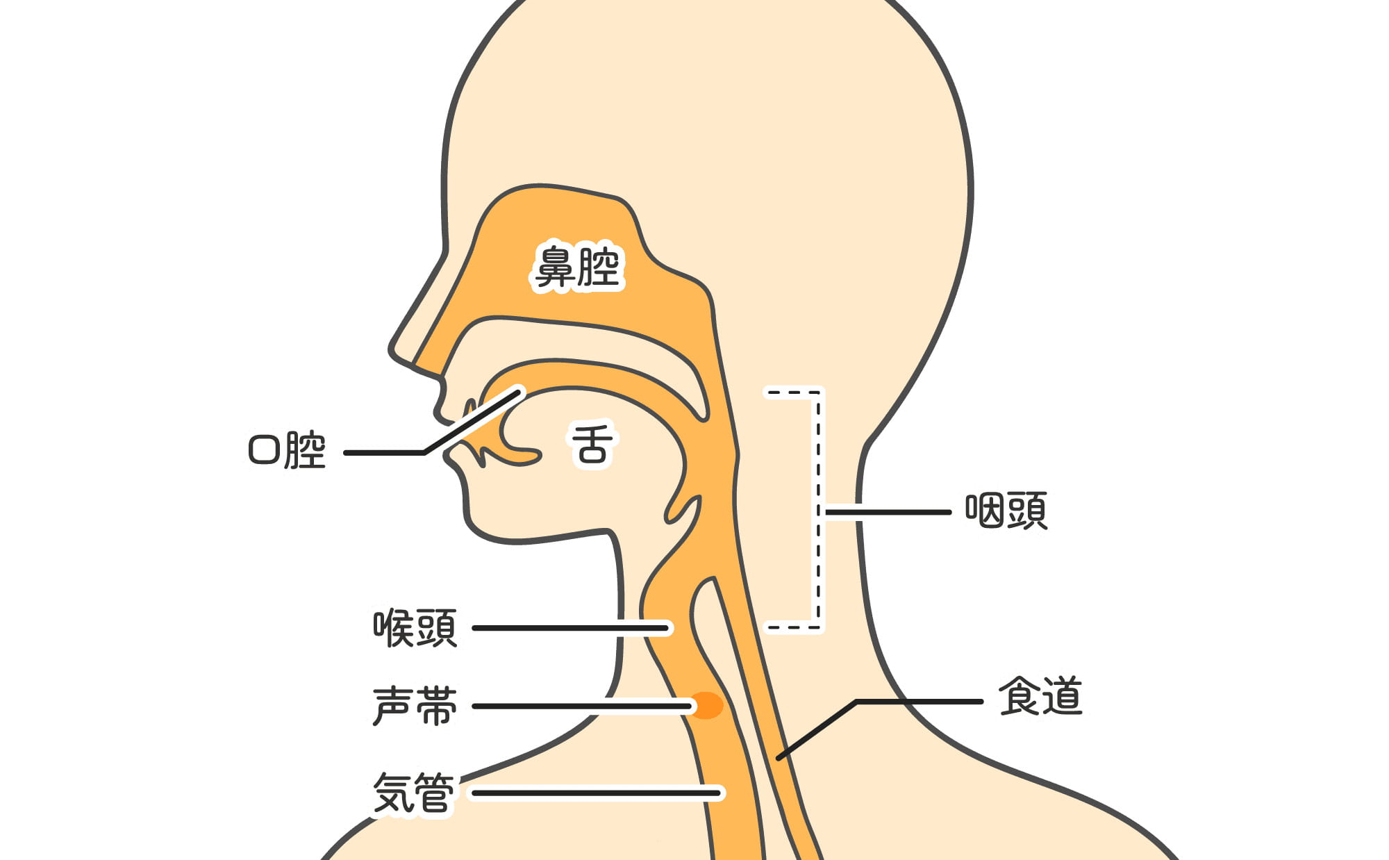 咽喉頭炎